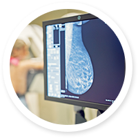 Breast Imaging