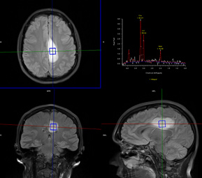 Neuroradiology2