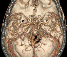 Neuroradiology3