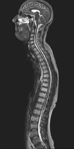 Neuroradiology1