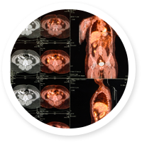 Nuclear Medicine & PET/CT