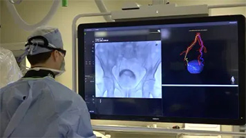 Interventional Radiology: Prostate Artery Embolization
