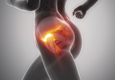 Pelvic Pain / Pelvic Congestion Syndrome